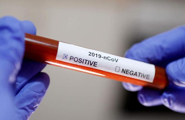 The number of coronavirus positive cases in UP are 773 in 48 districts. (Representative image) The number of coronavirus positive cases in UP are 773 in 48 districts. (Representative image)
