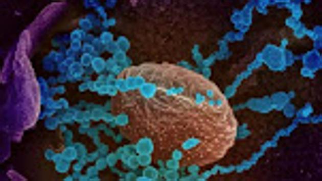 The institute will perform sequencing of the SARS-Cov-2 RNA genome isolated from the clinical samples it will receive as a testing facility. (HT FILE PHOTO) The institute will perform sequencing of the SARS-Cov-2 RNA genome isolated from the clinical samples it will receive as a testing facility. (HT FILE PHOTO)