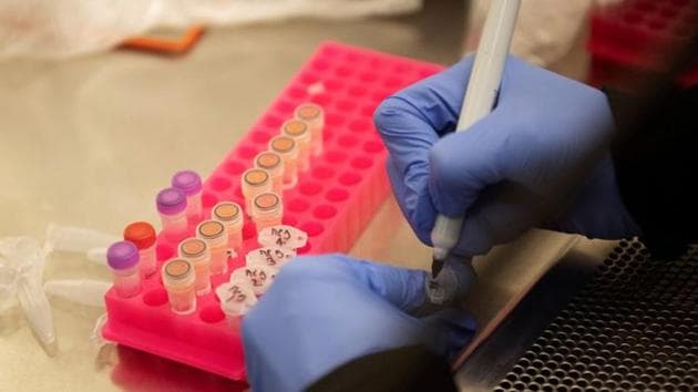 However, no antibody tests are available in the country now, as it is not manufactured in India. (Reuters file photo. Representative image) However, no antibody tests are available in the country now, as it is not manufactured in India. (Reuters file photo. Representative image)