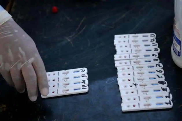 Rapid Covid-19 blood test kits sit (AFP) Rapid Covid-19 blood test kits sit (AFP)