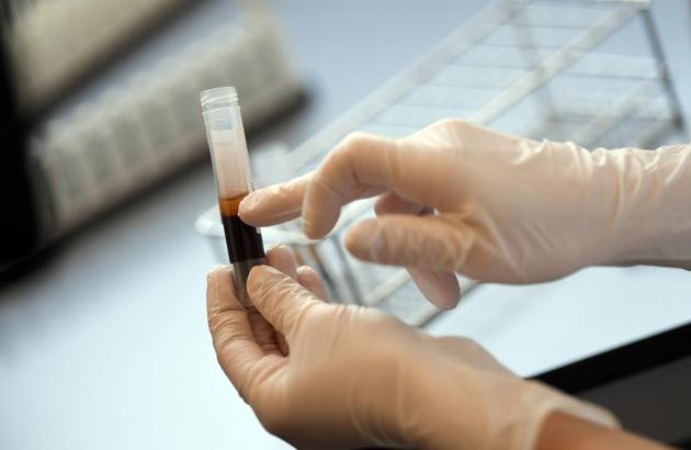 3,200 samples were sent to laboratories on Thursday and 2,962 samples were tested in various laboratories across the state. (REUTERS)
