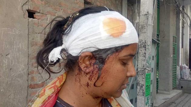 One of the injured in the clash that broke out in Ludhiana’s Punjabi Bagh area on Tibba road on Saturday. (Gurpreet Singh/HT) One of the injured in the clash that broke out in Ludhiana’s Punjabi Bagh area on Tibba road on Saturday. (Gurpreet Singh/HT)