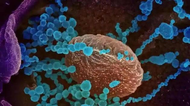 This scanning electron microscope image shows SARS-CoV-2 (round blue objects), also known as novel coronavirus, the virus that causes COVID-19, emerging from the surface of cells cultured in the lab which was isolated from a patient in US (Reuters Photo) This scanning electron microscope image shows SARS-CoV-2 (round blue objects), also known as novel coronavirus, the virus that causes COVID-19, emerging from the surface of cells cultured in the lab which was isolated from a patient in US (Reuters Photo)