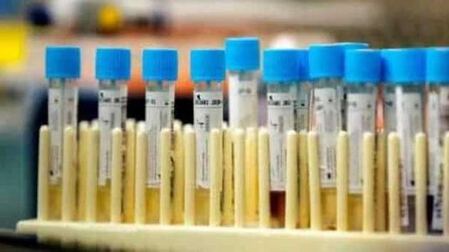 The health department has deployed a mobile medical unit in crowded localities of the city to collect “pool” samples for random Covid-19 testing of vegetable and fruit vendors, hawkers, chemists, etc. The health department has deployed a mobile medical unit in crowded localities of the city to collect “pool” samples for random Covid-19 testing of vegetable and fruit vendors, hawkers, chemists, etc.