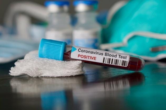 A major chunk of Covid positive cases in the state were reported from Tablighi Jamaat members, as well as from patients discharged from hospitals. A major chunk of Covid positive cases in the state were reported from Tablighi Jamaat members, as well as from patients discharged from hospitals.