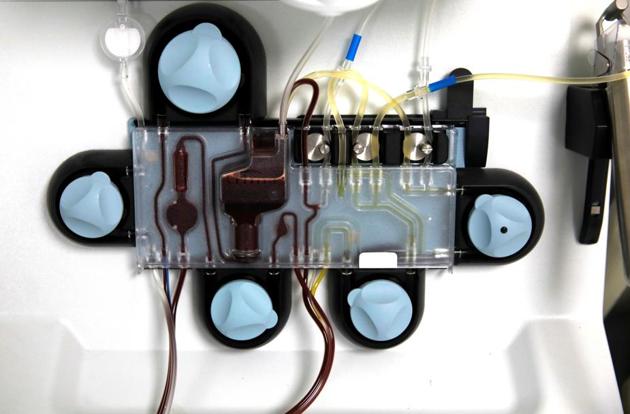 After plasma is donated, it will be screened and given to a patient under medical observation. After plasma is donated, it will be screened and given to a patient under medical observation.