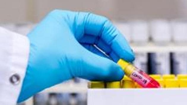 Pune-based Serum Institute of India (SII) has partnered with the Oxford University to manufacture the vaccine in India even as the trial starts.(Bloomberg file photo. Representative image) Pune-based Serum Institute of India (SII) has partnered with the Oxford University to manufacture the vaccine in India even as the trial starts.(Bloomberg file photo. Representative image)
