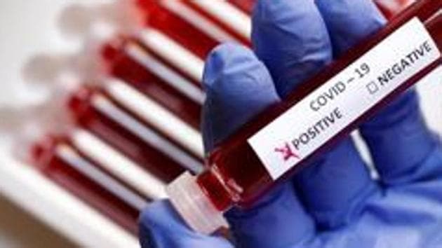 The researchers analysed multiple Human Cell Atlas (HCA), which provides reference maps of all the cells in the body. (Reuters file photo. Representative image) The researchers analysed multiple Human Cell Atlas (HCA), which provides reference maps of all the cells in the body. (Reuters file photo. Representative image)