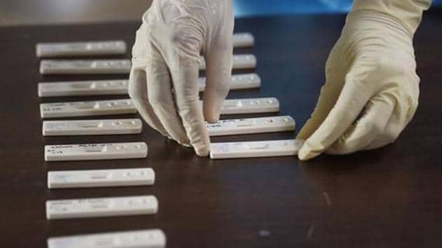 To make the kits, sections of the viral protein coat that triggers an immune reaction are produced in the lab using cell lines for inclusion in the serological test to detect antibodies.(PTI file photo. Representative image)