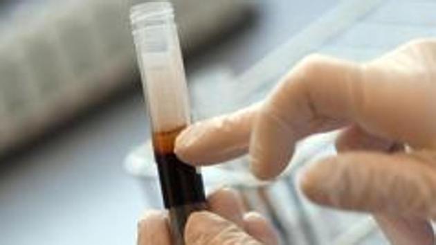 Plasma therapy is still in trials stage and is not an approved treatment for coronavirus, health ministry officials had said a couple of days ago.(REUTERS Photo/representative) Plasma therapy is still in trials stage and is not an approved treatment for coronavirus, health ministry officials had said a couple of days ago.(REUTERS Photo/representative)