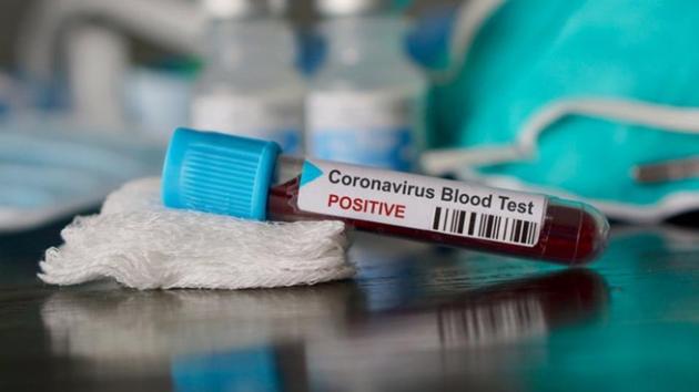 The scientist was posted at Viral Research and Diagnostic Laboratory at the department of microbiology, Banaras Hindu University. (Representative image/istock image) The scientist was posted at Viral Research and Diagnostic Laboratory at the department of microbiology, Banaras Hindu University. (Representative image/istock image)