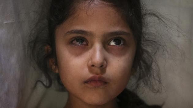 Six-year-old Muneefa Nazir, a Kashmiri girl whose right eye was hit by a marble ball, shot allegedly by security forces on August 12, 2019, stands outside her home in Srinagar on September 17, 2019. The image was part of a series of photographs by Associated Press photographers which won the 2020 Pulitzer Prize for Feature Photography. (Mukhtar Khan / AP)