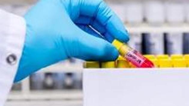 A laboratory worker removes a test tube containing a patient's sample from a box during coronavirus detection tests in the virology research labs at UZ Leuven university hospital in Leuven, Belgium(Bloomberg File Photo/Representative Image)