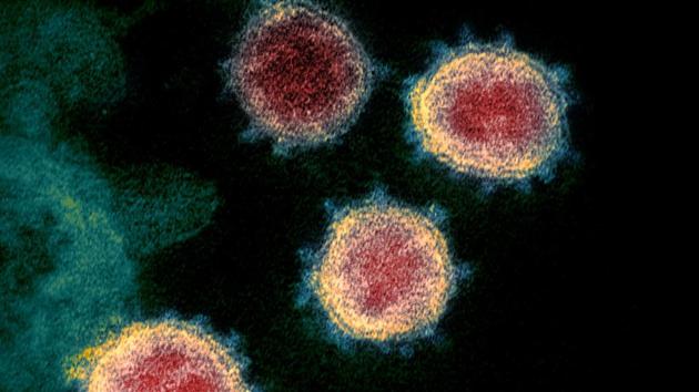 This undated electron microscope image made available by the US National Institutes of Health in February 2020 shows the virus that causes COVID-19. The sample was isolated from a patient in the US Excitement about treating the new coronavirus with malaria drugs is raising hopes, but the evidence that they may help is thin. (AP) This undated electron microscope image made available by the US National Institutes of Health in February 2020 shows the virus that causes COVID-19. The sample was isolated from a patient in the US Excitement about treating the new coronavirus with malaria drugs is raising hopes, but the evidence that they may help is thin. (AP)
