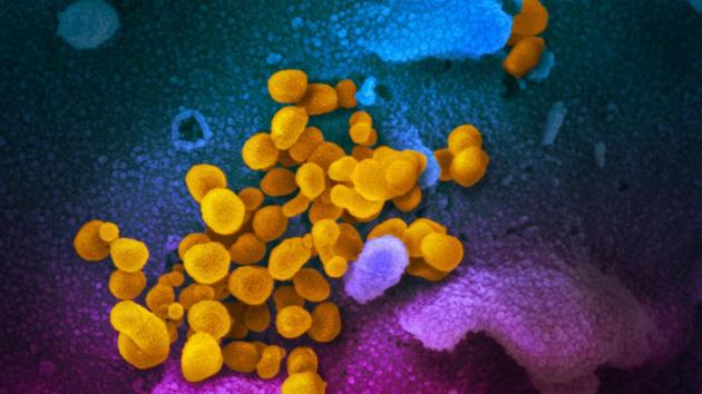 An undated scanning electron microscope image shows SARS-CoV-2 (yellow), also known as novel coronavirus, the virus that causes Covid-19, isolated from a patient in the US, emerging from the surface of cells (blue/pink) cultured in the lab.(via REUTERS)