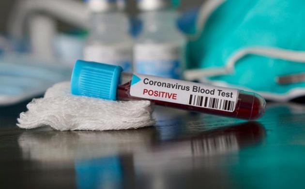 The total number of coronavirus cases in the state now stands at 3,071. So far, a total of 1,250 patients have been discharged. (istock image/Representative image) The total number of coronavirus cases in the state now stands at 3,071. So far, a total of 1,250 patients have been discharged. (istock image/Representative image)