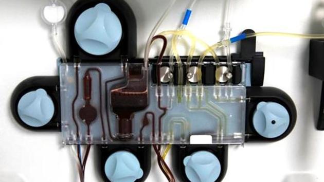 Convalescent plasma therapy is an experimental procedure for Covid-19 patients. In this treatment, plasma, a blood component, from a cured patient is transfused to a critically ill coronavirus patient. (Reuters file photo. Representative image) Convalescent plasma therapy is an experimental procedure for Covid-19 patients. In this treatment, plasma, a blood component, from a cured patient is transfused to a critically ill coronavirus patient. (Reuters file photo. Representative image)