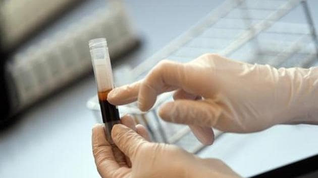 The blood of the donor can be used for therapeutic plasma for the treatment of seriously ill patients during the clinical trials.(REUTERS Photo) The blood of the donor can be used for therapeutic plasma for the treatment of seriously ill patients during the clinical trials.(REUTERS Photo)