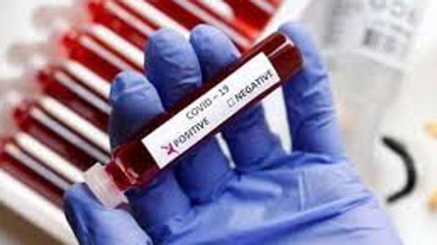 A PGIMER health expert said the high number of cases in Chandigarh could be due to high population density as seen in Delhi and Mumbai. (HT file photo) A PGIMER health expert said the high number of cases in Chandigarh could be due to high population density as seen in Delhi and Mumbai. (HT file photo)