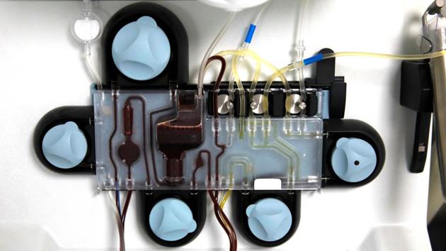 Blood donated by a biologist, who recovered from coronavirus disease (COVID-19), is processed in a device for being used for plasma therapy to treat other patients with the disease at Medicana International Hospital in Istanbul, Turkey. (REUTERS) Blood donated by a biologist, who recovered from coronavirus disease (COVID-19), is processed in a device for being used for plasma therapy to treat other patients with the disease at Medicana International Hospital in Istanbul, Turkey. (REUTERS)