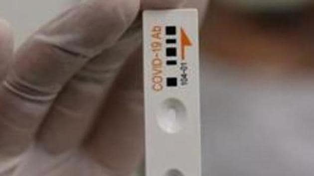 An employee holds up an antibody test cartridge of the ichroma COVID-19 (AP) An employee holds up an antibody test cartridge of the ichroma COVID-19 (AP)