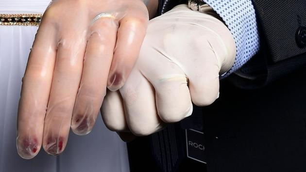 Newly-wed Italians Ester Concilio (L) and Rafaele Carbonelli show wedding rings under the protective gloves following the ceremony at the Briosco’s town hall, on May 11. In light of the Mayor’s restricting any ceremonies during the lockdown, the couple decided to get married without a banquet or any guests. (Miguel Medina / AFP)