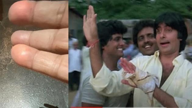 Amitabh Bachchan shows the improvement after his finger injury which made him camouflage it in his films.
