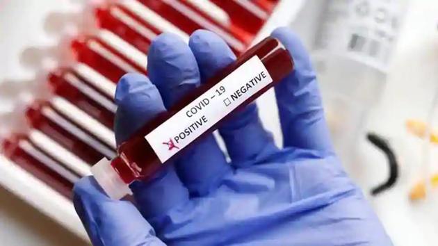 Telengana tests 664 per million while the country tests 1660 per million. (Reuters file photo) Telengana tests 664 per million while the country tests 1660 per million. (Reuters file photo)