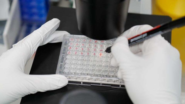 A scientist examines Covid-19 infected cells during research for a vaccine at a laboratory in Saint Petersburg, Russia on Wednesday.(Reuters Photo) A scientist examines Covid-19 infected cells during research for a vaccine at a laboratory in Saint Petersburg, Russia on Wednesday.(Reuters Photo)