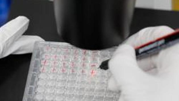Only a handful of the vaccines in development have advanced to human trials, an indicator of safety and efficacy, and the stage at which most fail. (REUTERS) Only a handful of the vaccines in development have advanced to human trials, an indicator of safety and efficacy, and the stage at which most fail. (REUTERS)