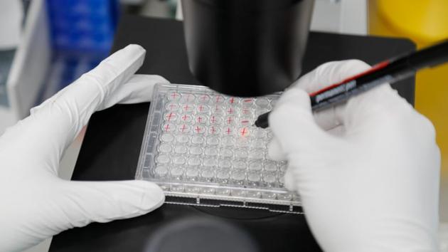 A scientist examines Covid-19 infected cells during research for a vaccine at a laboratory in Saint Petersburg, Russia on Wednesday.(Reuters Photo) A scientist examines Covid-19 infected cells during research for a vaccine at a laboratory in Saint Petersburg, Russia on Wednesday.(Reuters Photo)