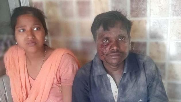 The migrant couple who suffered injuries in the roof collapse in on Thursday. (HT Photo) The migrant couple who suffered injuries in the roof collapse in on Thursday. (HT Photo)