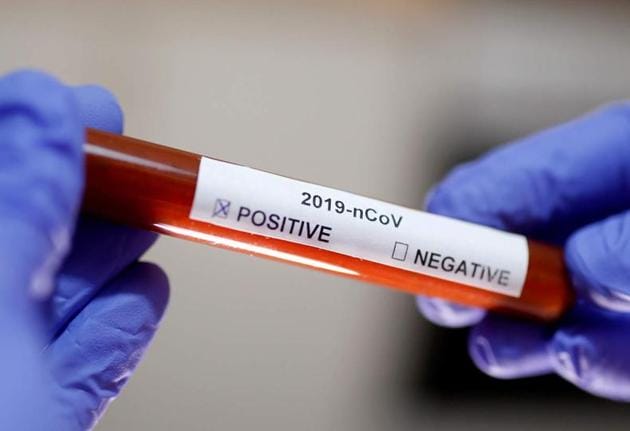 In Gorakhpur district, three people have died of Covid-19 infection, while there are 23 active patients and three cured cases.