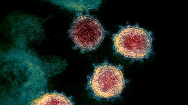 This undated transmission electron microscope image shows SARS-CoV-2, also known as novel coronavirus, the virus that causes COVID-19, isolated from a patient in the US.(REUTERS) This undated transmission electron microscope image shows SARS-CoV-2, also known as novel coronavirus, the virus that causes COVID-19, isolated from a patient in the US.(REUTERS)