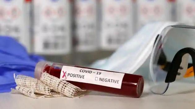 A senior Parliament official working in editorial and translation (E&T) services has tested positive for the coronavirus disease (Covid-19), people familiar with the matter said. (File photo for representation) A senior Parliament official working in editorial and translation (E&T) services has tested positive for the coronavirus disease (Covid-19), people familiar with the matter said. (File photo for representation)