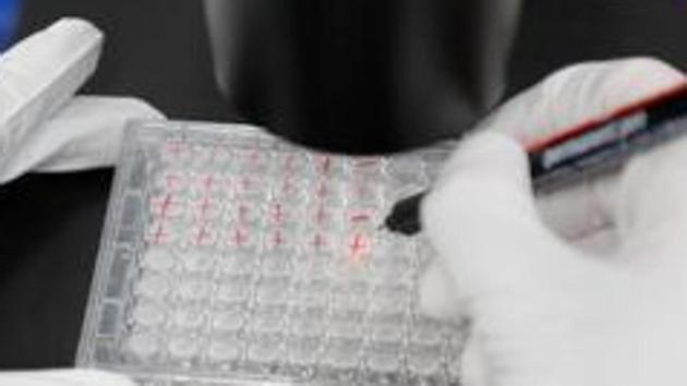 The experimental vaccine, known as ChAdOx1 nCoV-19, is one of the front-runners in the global race to provide protection against the new coronavirus causing the coronavirus pandemic.(Reuters file photo. Representative image) The experimental vaccine, known as ChAdOx1 nCoV-19, is one of the front-runners in the global race to provide protection against the new coronavirus causing the coronavirus pandemic.(Reuters file photo. Representative image)