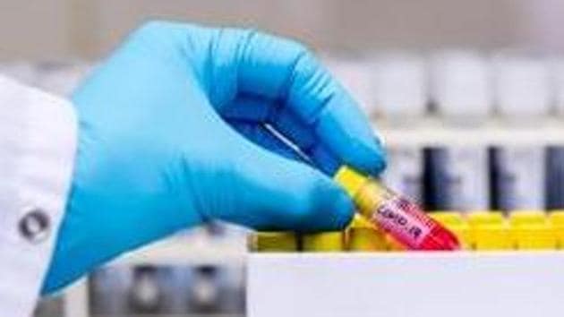 Ludhiana currently has 33 active cases.(Bloomberg) Ludhiana currently has 33 active cases.(Bloomberg)