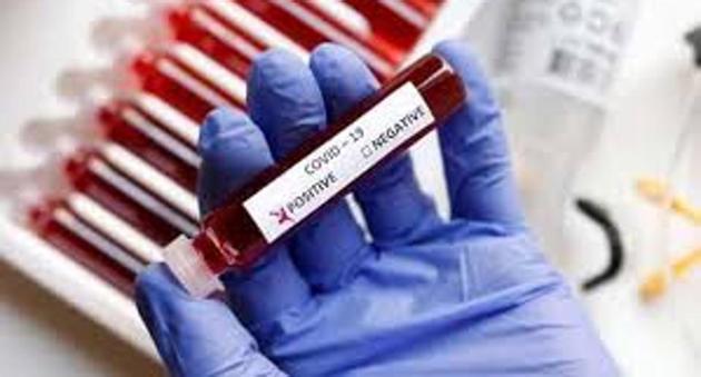 Earlier, a report by experts on the outbreak of Covid-19 in the city’s largest containment zone, Bapu Dham Colony, had also suggested a similar exercise. (HT FILE) Earlier, a report by experts on the outbreak of Covid-19 in the city’s largest containment zone, Bapu Dham Colony, had also suggested a similar exercise. (HT FILE)