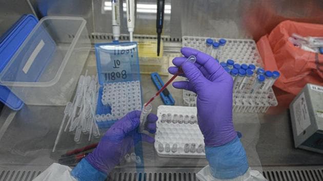 Uttarakahnd is grappling with a huge backlog in the results of samples sent for Covid-19 tests. (HT PHOTO) Uttarakahnd is grappling with a huge backlog in the results of samples sent for Covid-19 tests. (HT PHOTO)