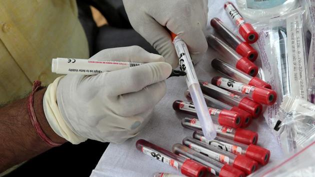 Swab samples collected from elephants for Covid-19 testing seen during a medical camp. Mathur said the results of the tests are expected in seven to 10 days. (Himanshu Vyas / HT Photo)