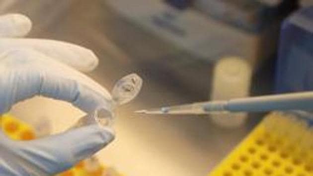 A scientist dilutes samples during the research and development of a vaccine against the coronavirus disease (COVID-19) at a laboratory of BIOCAD biotechnology company in Saint Petersburg, Russia.(REUTERS)