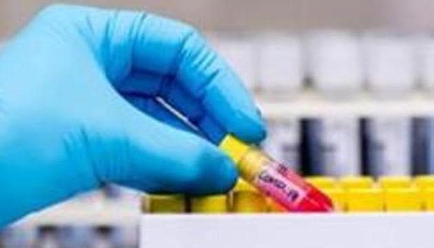 Maharashtra Health minister Rajesh Tope  announced the decision of capping the test price after a committee of senior health department officials submitted its report on the issue. (Representative image/Bloomberg)