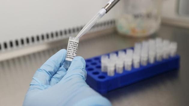 In the research, the scientists analysed the antibody test results from 177 individuals diagnosed with Covid-19, and measured the levels of antibodies against the novel coronavirus they had.(REUTERS) In the research, the scientists analysed the antibody test results from 177 individuals diagnosed with Covid-19, and measured the levels of antibodies against the novel coronavirus they had.(REUTERS)