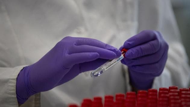 The stimulation of innate immunity by attenuated vaccines -- live but with substantially reduced virulence -- in general and OPV in particular could provide temporary protection against Covid-19, the scientists noted. (AP Photo. Representative image) The stimulation of innate immunity by attenuated vaccines -- live but with substantially reduced virulence -- in general and OPV in particular could provide temporary protection against Covid-19, the scientists noted. (AP Photo. Representative image)