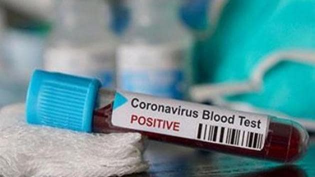 All the prescribed protocols and health safety standards are being followed as precautionary measures, according to a Chhattisgarh government’s press release.(ANI File)
