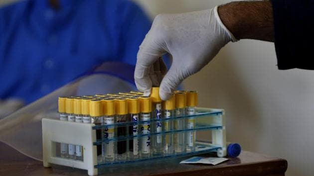 According to the Ministry of National Health Services, Pakistan reported 4,951 new coronavirus cases in the last 24 hours, taking the nation’s tally to 176,617 on Sunday. (AP file photo. Representative image) According to the Ministry of National Health Services, Pakistan reported 4,951 new coronavirus cases in the last 24 hours, taking the nation’s tally to 176,617 on Sunday. (AP file photo. Representative image)