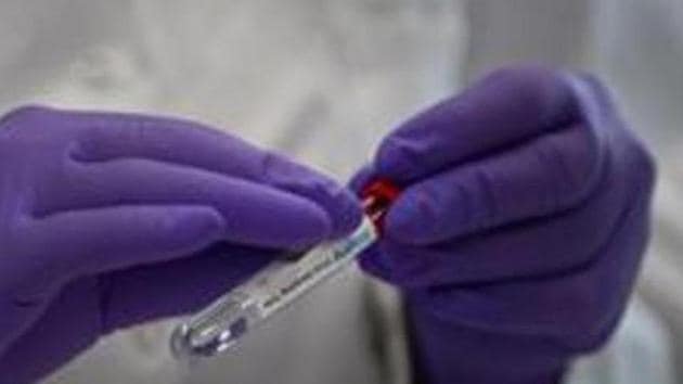 The large-scale trial is being conducted in South Africa, Britain and Brazil.(AP) The large-scale trial is being conducted in South Africa, Britain and Brazil.(AP)