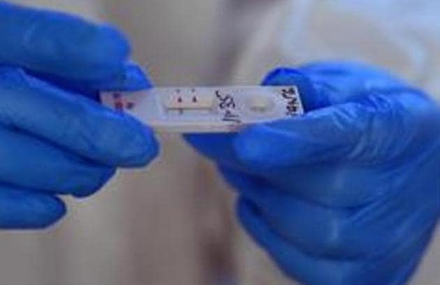 As many as 17 patients from other districts and states have succumbed to the virus in various city hospitals. (Representative photo) As many as 17 patients from other districts and states have succumbed to the virus in various city hospitals. (Representative photo)