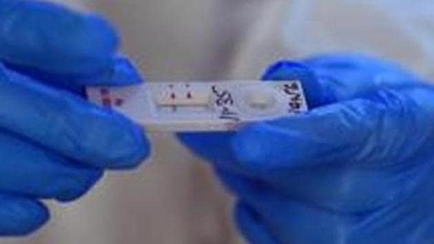 ICMR is sending 200 test kits to Rajasthan for the trial. (Raj K Raj/HT PHOTO) ICMR is sending 200 test kits to Rajasthan for the trial. (Raj K Raj/HT PHOTO)