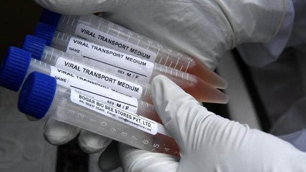 A health worker carrying tubes of samples collected from people for the COVID-19 test at Gomti Nagar in Lucknow on June 26. According to the Indian Council of Medical Research (ICMR), the total number of samples tested up to June 27 is 82,27,802, while the number of samples tested just on June 27 stands at 2,31,095. (Dheeraj Dhawan / HT Photo)